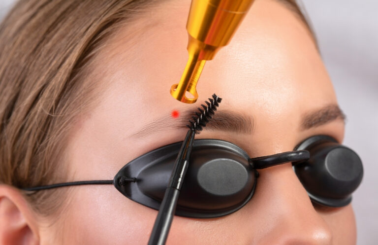 Microblading Removal in West Delhi