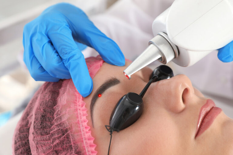 All You Need to Know About Microblading Removal