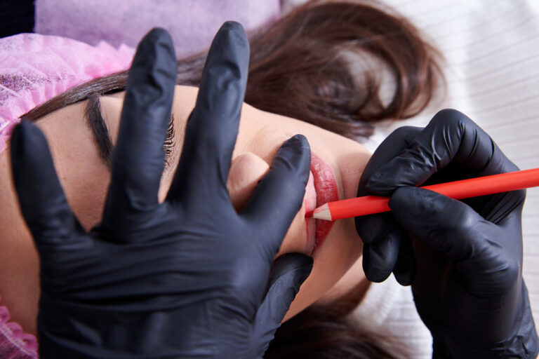 How to Get Rid of Dark Over Lip: Causes, Remedies & Treatments