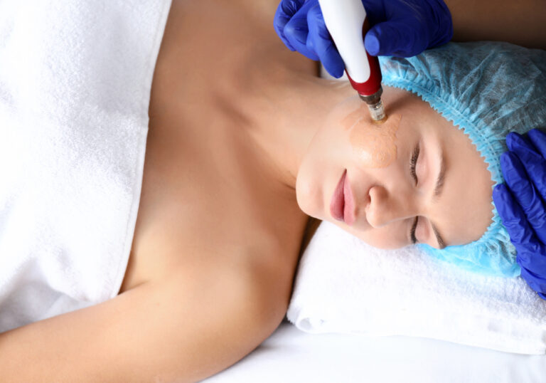 Best Skin Peel Treatment Delhi 2024