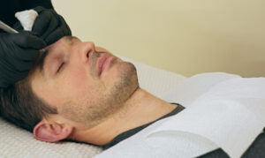 Botox for Fine Lines