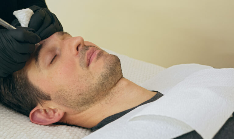 When Botox Wears Off: Understanding the Timeline for Wrinkle Return