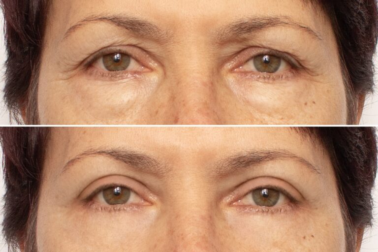 Laser Treatment Clinic Near Me: Expert Skin Solutions