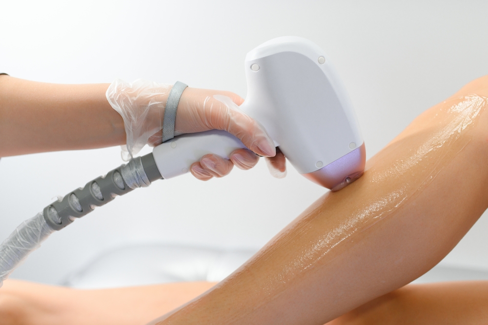 Laser Hair Removal