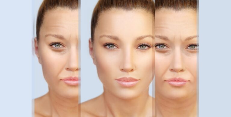 Can Vaseline Remove Dark Lips Naturally and Effectively?