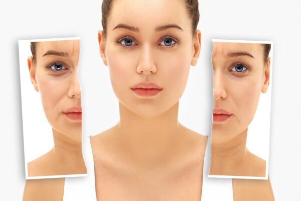 Botox Procedure