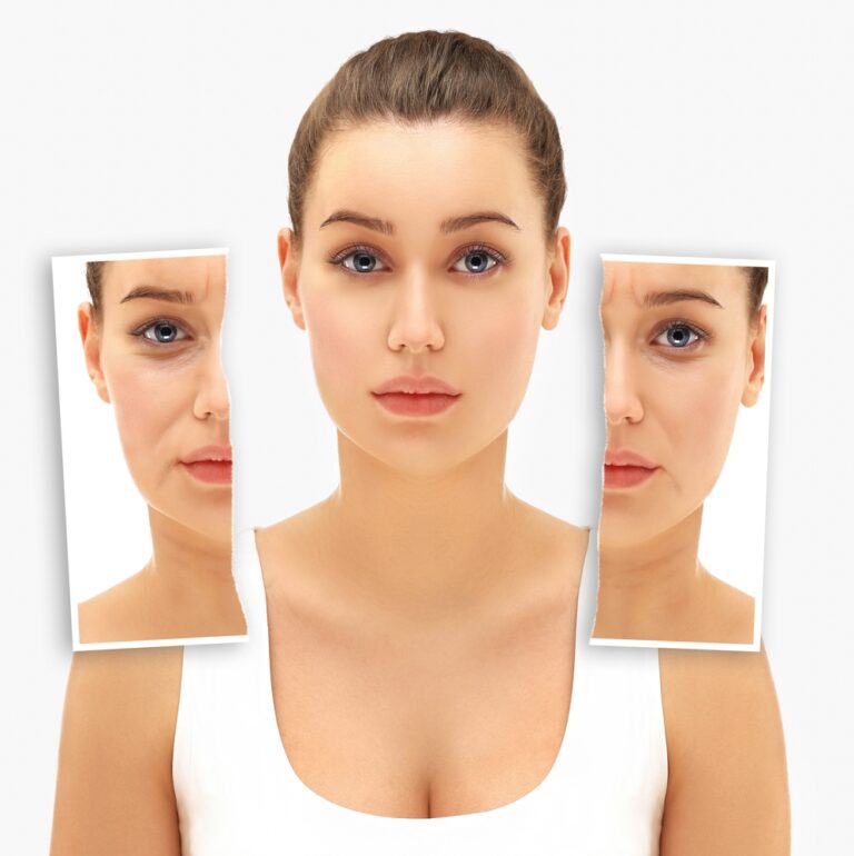 Will Fillers Reduce Wrinkles? Effective Solutions for Smooth Skin