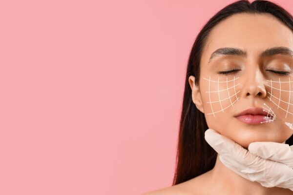 Laser Treatment for Pigmentation