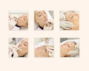 Anti-Aging Botox
