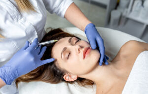 When Fillers Wear Off