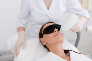 Laser Treatment for Acne Marks
