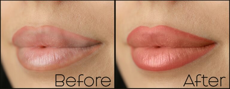 Lip Care Routine for Dark Lips: Restore Your Natural Pink Glow