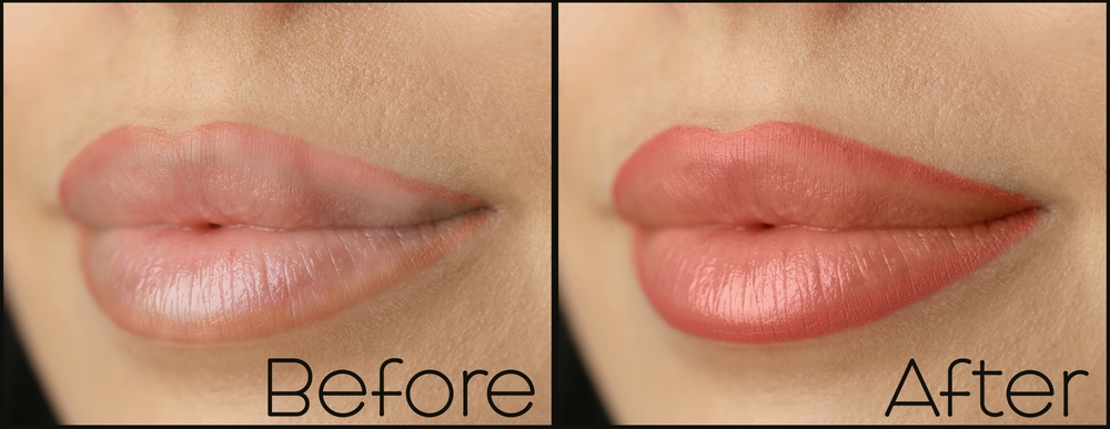 How to Lighten Dark Lips