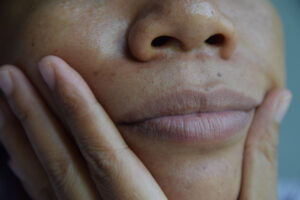 How to Remove Blackness from Lips