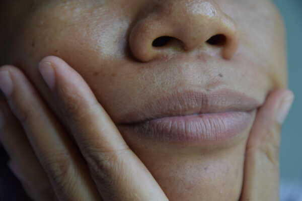 How to Remove Blackness from Lips