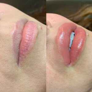 Why Do Lips Turn Black