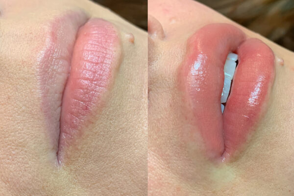 Why Do Lips Turn Black