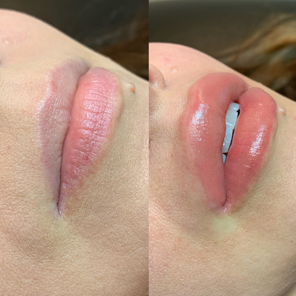 Why Do Lips Turn Black