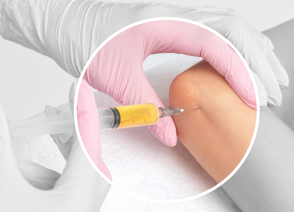 PRP Treatment for the Knee
