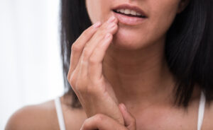 Facial Rejuvenation