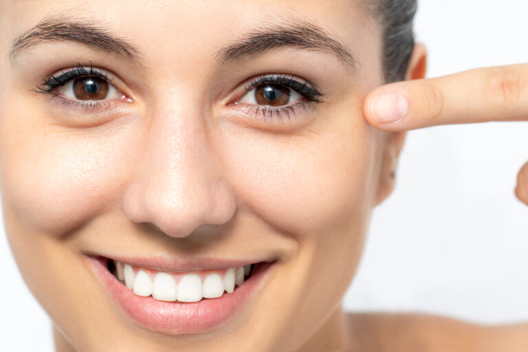 Crow’s Feet: Causes, Treatments, and Prevention Tips
