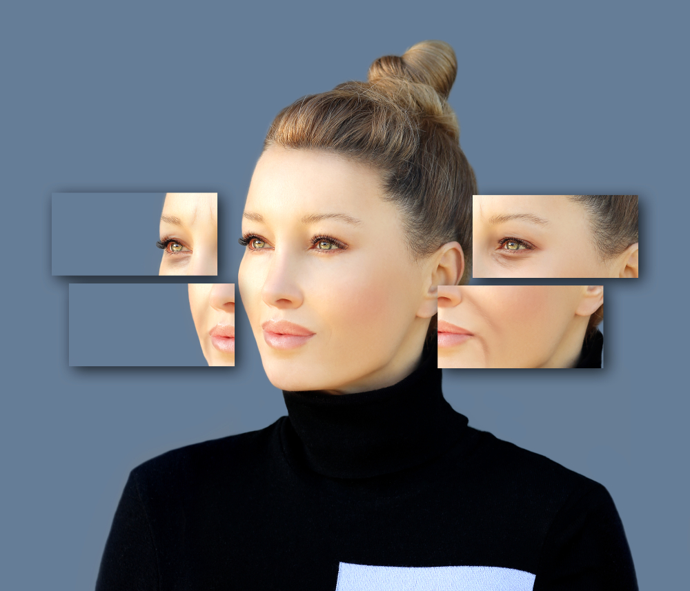 Botox Longevity